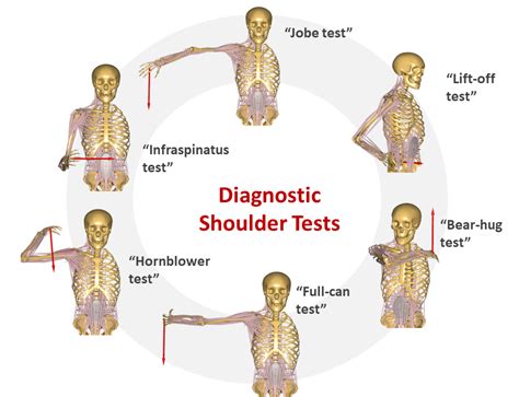 test for torn shoulder cuff